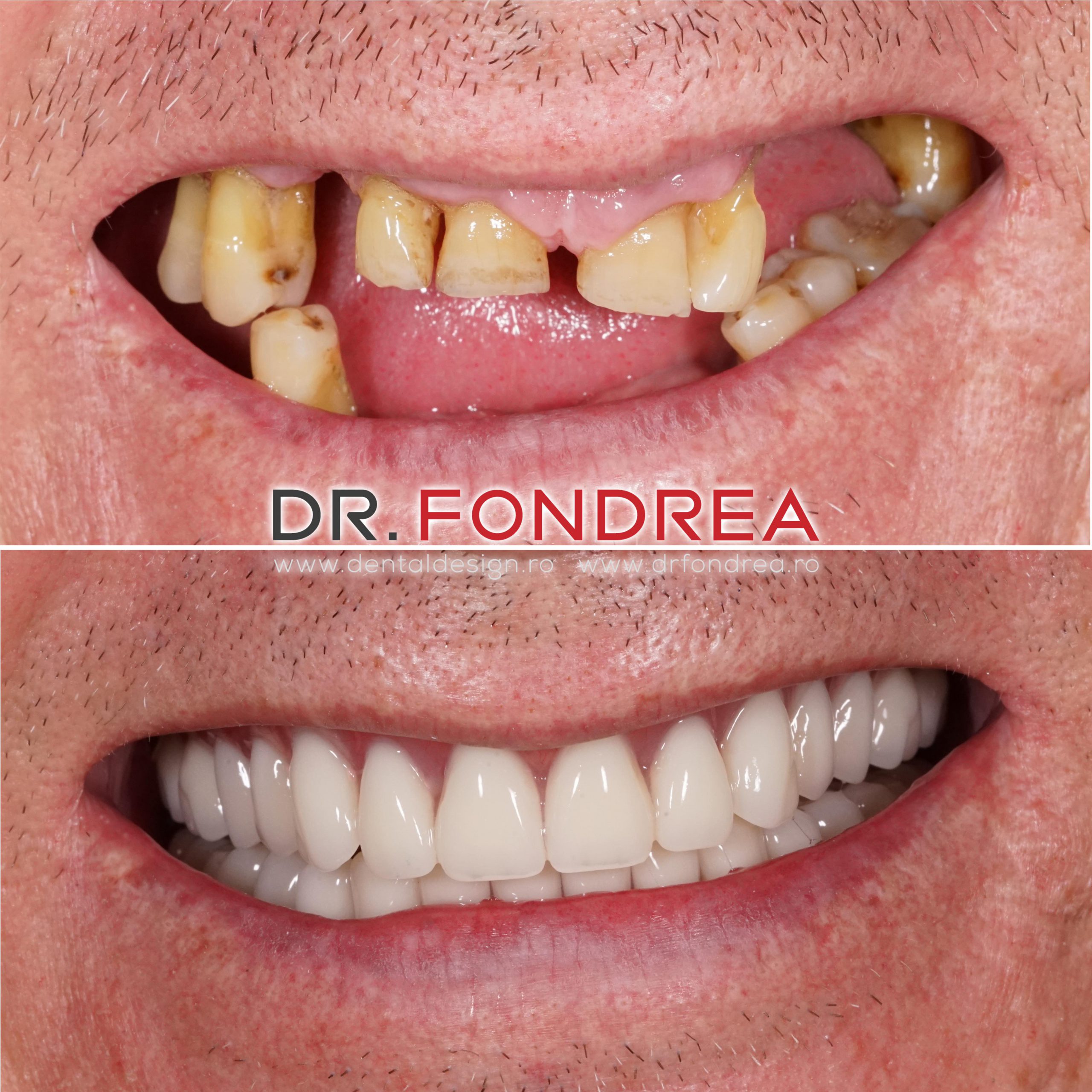 Pro Bono 2020 Dental Design Dr. Bogdan Fondrea